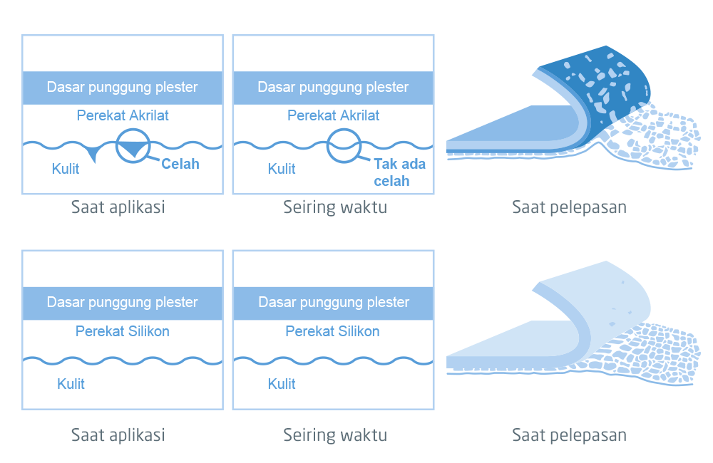 Ilustrasi yang menunjukkan perbedaan antara perekat standar dan perekat silikon saat dipasang, seiring waktu, dan saat dilepaskan. Ilustrasi yang menunjukkan perbedaan antara perekat standar dan perekat silikon saat dipasang, seiring waktu, dan saat dilepaskan.